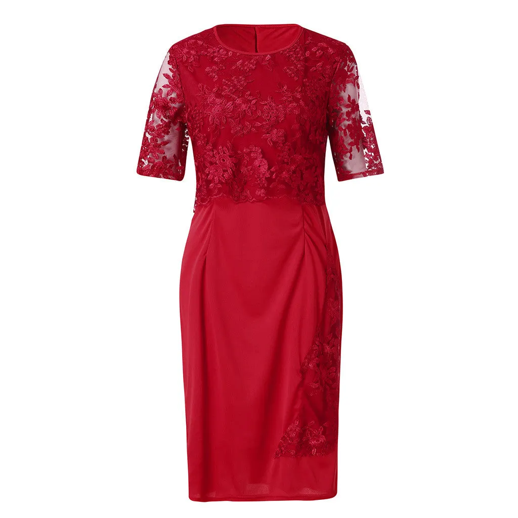 Short Sleeve Lace Stitching Knee-Length Dress